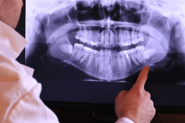 Best Cosmetic Emergency Dentistry in Connelly Springs, NC