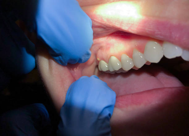 Best Same-Day Emergency Dental Services in Connelly Springs, NC