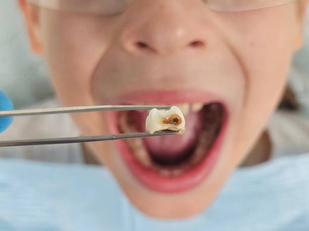 Best Same-Day Emergency Dental Services in Connelly Springs, NC